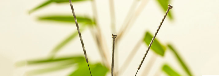 Chiropractic Gurnee IL Acupuncture Needles